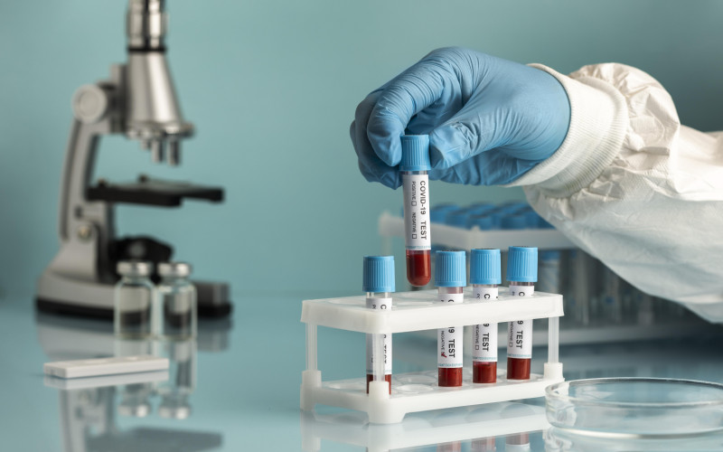 Blood Test